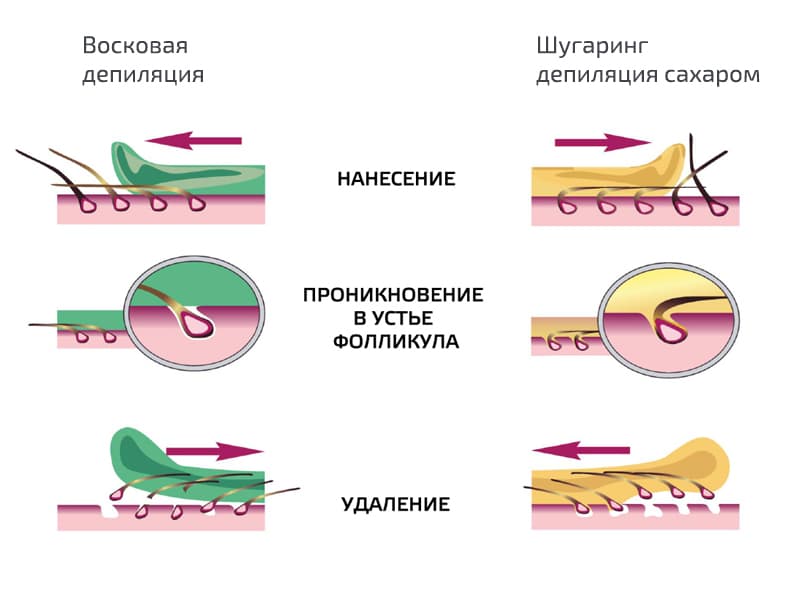 Что такое шугаринг Что такое шугаринг